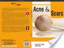 ACNE e cicatrici - ACNE and SCARS