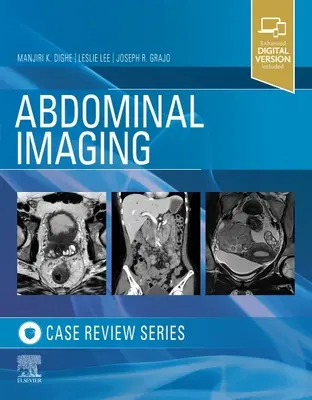 Imaging addominale: Serie di analisi dei casi - Abdominal Imaging: Case Review Series