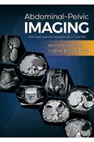 Imaging addomino-pelvico - 200 casi (malattie comuni): US, TC e RM - Abdominal-Pelvic Imaging - 200 Cases (Common Diseases): US, CT and MRI