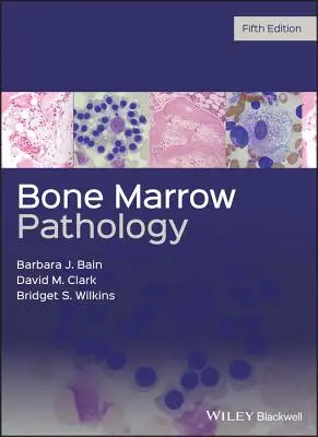 Patologia del midollo osseo - Bone Marrow Pathology