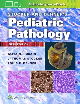 Patologia pediatrica di Stocker e Dehner - Stocker and Dehner's Pediatric Pathology