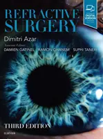 Chirurgia refrattiva - Refractive Surgery