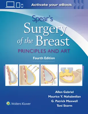 Spear's Surgery of the Breast: Principi e arte - Spear's Surgery of the Breast: Principles and Art