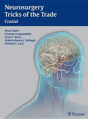 Trucchi del mestiere in neurochirurgia - Cranio: Cranio - Neurosurgery Tricks of the Trade - Cranial: Cranial
