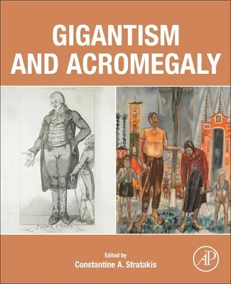 Gigantismo e acromegalia - Gigantism and Acromegaly