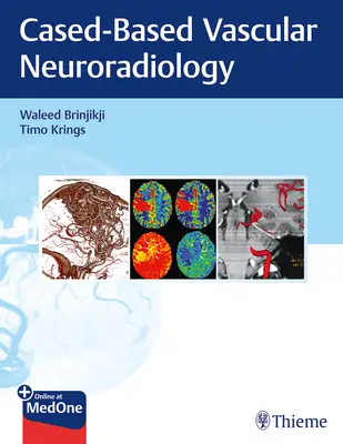 Imaging nelle malattie neurovascolari: Un approccio basato sui casi - Imaging in Neurovascular Disease: A Case-Based Approach