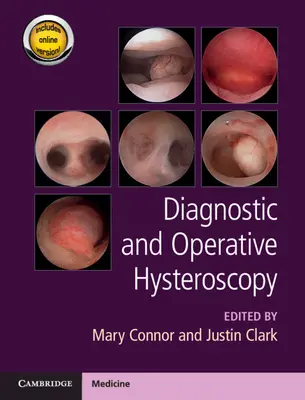 Isteroscopia diagnostica e operativa - Diagnostic and Operative Hysteroscopy