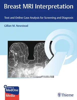 Interpretazione della risonanza magnetica al seno: Testo e analisi di casi online per lo screening e la diagnosi - Breast MRI Interpretation: Text and Online Case Analysis for Screening and Diagnosis