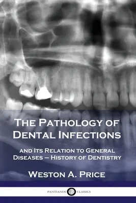 La patologia delle infezioni dentali e la sua relazione con le malattie generali - Storia dell'odontoiatria - The Pathology of Dental Infections: and Its Relation to General Diseases - History of Dentistry
