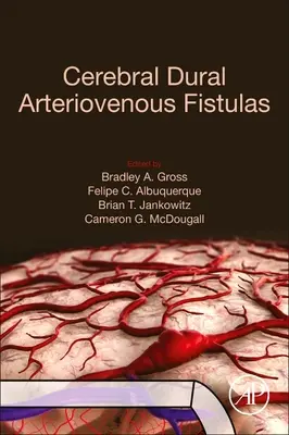 Fistole arteriovenose cerebrali - Cerebral Dural Arteriovenous Fistulas