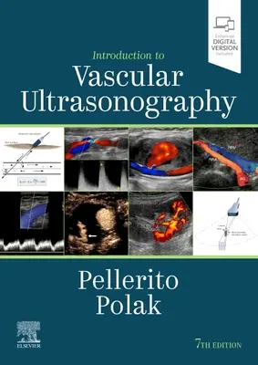 Introduzione all'ultrasonografia vascolare - Introduction to Vascular Ultrasonography