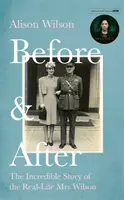 Prima e dopo - L'incredibile storia della vera signora Wilson - Before & After - The Incredible Story of the Real-life Mrs Wilson