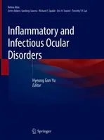 Disturbi oculari infiammatori e infettivi - Inflammatory and Infectious Ocular Disorders