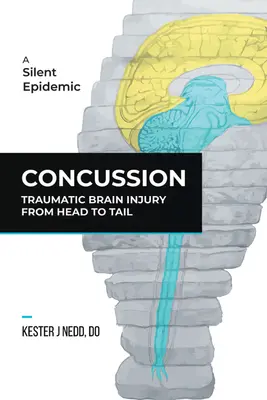 Commozione cerebrale: Lesioni cerebrali traumatiche dalla testa alla coda - Concussion: Traumatic Brain Injury from Head to Tail