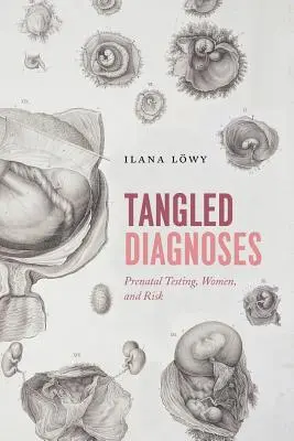 Diagnosi intricate: Test prenatali, donne e rischi - Tangled Diagnoses: Prenatal Testing, Women, and Risk
