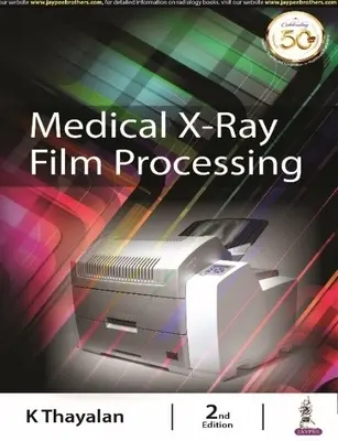 Elaborazione di pellicole mediche a raggi X - Medical X-ray Film Processing