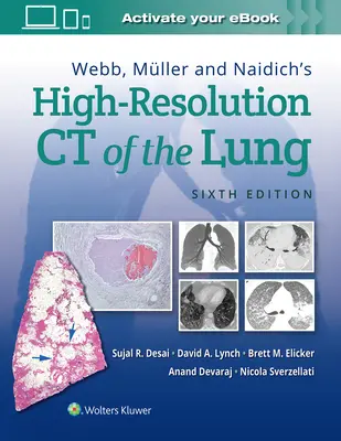 La TC ad alta risoluzione del polmone di Webb, Mller e Naidich - Webb, Mller and Naidich's High-Resolution CT of the Lung