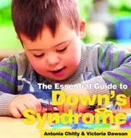Sindrome di Down: La guida essenziale - Down's Syndrome: The essential Guide