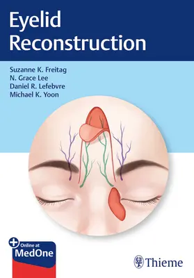 Ricostruzione delle palpebre - Eyelid Reconstruction