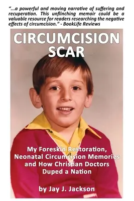 Cicatrice da circoncisione: Il mio restauro del prepuzio, i ricordi della circoncisione neonatale e come i medici cristiani hanno ingannato una nazione - Circumcision Scar: My Foreskin Restoration, Neonatal Circumcision Memories and How Christian Doctors Duped a Nation