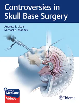 Controversie nella chirurgia della base cranica - Controversies in Skull Base Surgery
