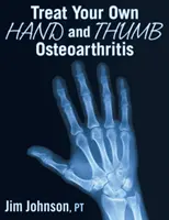 Curare l'osteoartrite di mani e pollici - Treat Your Own Hand and Thumb Osteoarthritis
