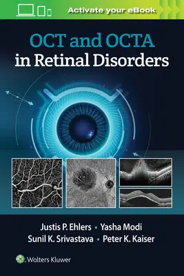 Oct e Octa nei disturbi della retina - Oct and Octa in Retinal Disorders