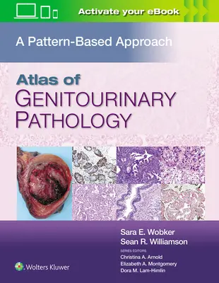 Atlante di patologia genitourinaria: Un approccio basato sui modelli - Atlas of Genitourinary Pathology: A Pattern Based Approach