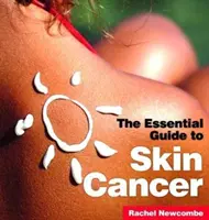Cancro della pelle: Guida essenziale - Skin Cancer: The Essential Guide