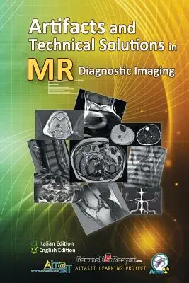 Artefatti e soluzioni tecniche nella diagnostica per immagini a risonanza magnetica - Artifacts and Technical Solutions in MR Diagnostic Imaging
