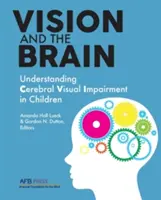 Visione e cervello: Capire i disturbi visivi cerebrali nei bambini - Vision and the Brain: Understanding Cerebral Visual Impairment in Children