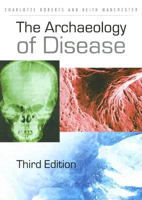 L'archeologia della malattia - The Archaeology of Disease