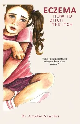 Eczema: Come eliminare il prurito - Eczema: How to Ditch the Itch