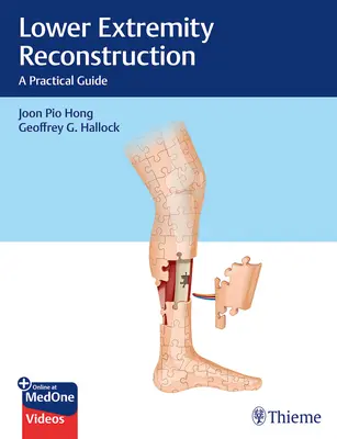 Ricostruzione degli arti inferiori: Una guida pratica - Lower Extremity Reconstruction: A Practical Guide