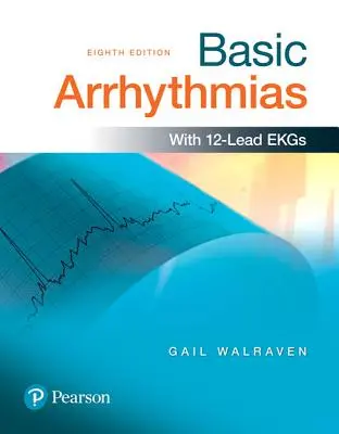 Aritmie di base - Basic Arrhythmias
