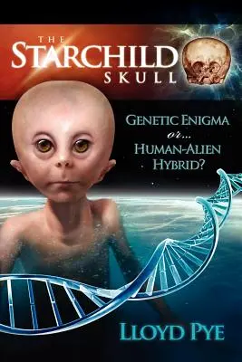 Il teschio di Starchild: enigma genetico o ibrido umano-alieno? - The Starchild Skull -- Genetic Enigma or Human-Alien Hybrid?