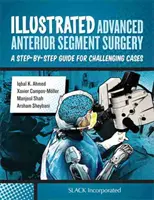 Chirurgia avanzata del segmento anteriore illustrata: Una guida passo-passo per i casi più difficili - Illustrated Advanced Anterior Segment Surgery: A Step-By-Step Guide for Challenging Cases