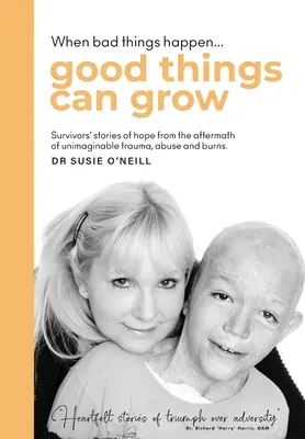 Quando le cose brutte accadono, le cose belle possono crescere: Le storie di speranza dei sopravvissuti alle conseguenze di traumi, abusi e ustioni inimmaginabili. - When bad things happen good things can grow: Survivors' stories of hope from the aftermath of unimaginable trauma, abuse and burns.