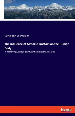 L'influenza dei trattori metallici sul corpo umano: nella rimozione di varie malattie infiammatorie dolorose - The Influence of Metallic Tractors on the Human Body: in removing various painful inflammatory diseases