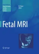 Risonanza magnetica fetale - Fetal MRI