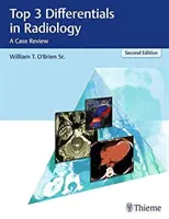 Top 3 Differenziali in Radiologia: Una rassegna di casi - Top 3 Differentials in Radiology: A Case Review