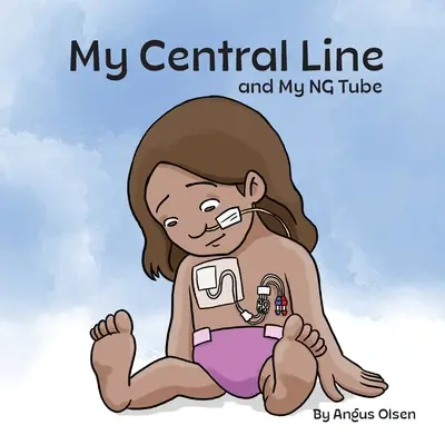 La mia linea centrale e il mio sondino naso-gastrico - My Central Line and My NG Tube