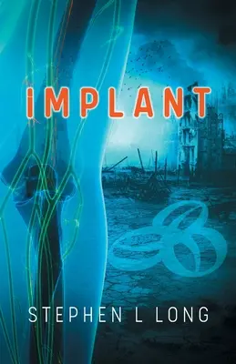 Impianto - Implant