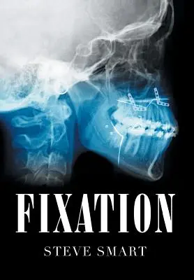 Fissazione - Fixation