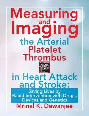 Misurazione e imaging del trombo piastrinico arterioso nell'infarto e nell'ictus: Salvare vite umane grazie a un intervento rapido con farmaci, dispositivi e genetica - Measuring and Imaging the Arterial Platelet Thrombus in Heart Attack and Stroke: Saving Lives by Rapid Intervention with Drugs, Devices and Genetics