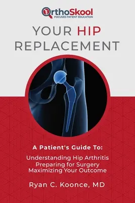 La protesi d'anca: Guida per il paziente a: Capire l'artrite dell'anca, prepararsi all'intervento, massimizzare i risultati - Your Hip Replacement: A Patient's Guide To: Understanding Hip Arthritis, Preparing for Surgery, Maximizing Your Outcome
