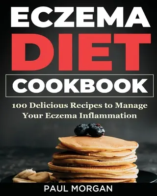 Ricettario dietetico per l'eczema: 100 deliziose ricette per gestire l'infiammazione dell'eczema - Eczema DIet Cookbook: 100 Delicious Recipes to Manage your Eczema Inflammation