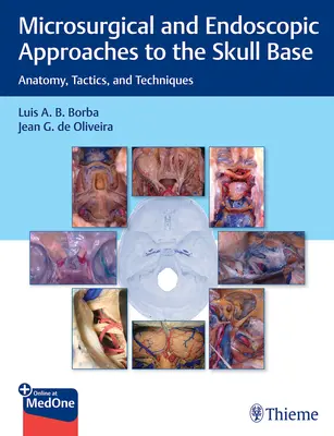 Approcci microchirurgici ed endoscopici alla base cranica: Anatomia, tattica e tecniche - Microsurgical and Endoscopic Approaches to the Skull Base: Anatomy, Tactics, and Techniques
