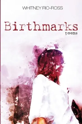 Punti di nascita - Birthmarks