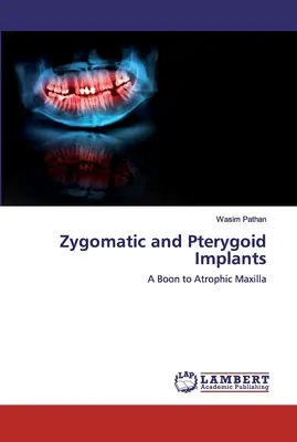 Impianti zigomatici e pterigoidei - Zygomatic and Pterygoid Implants